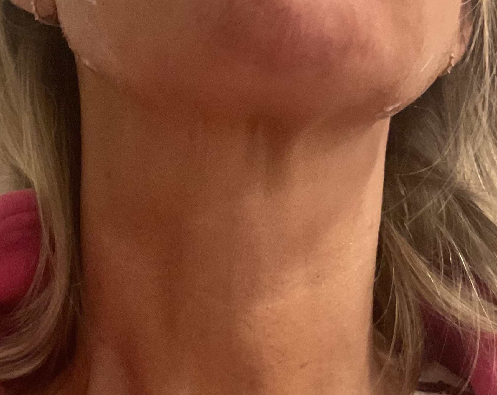 After