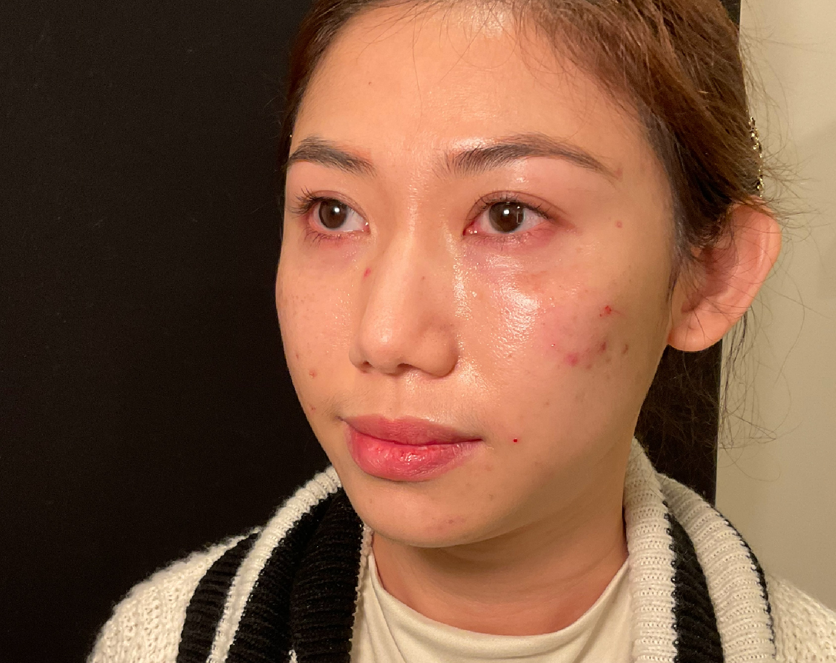 After