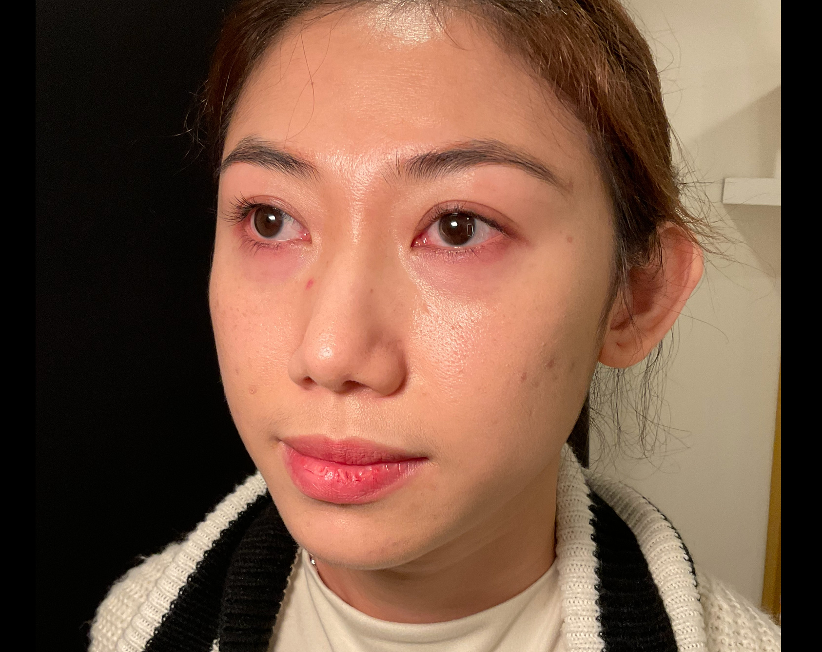 Before